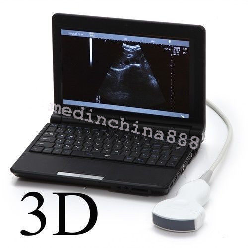 LCD Ultrasound Scanner Machine+Convex + Linear Probe+Sony Printer Best Offer 190891246417 DIAGNOSTIC ULTRASOUND MACHINES FOR SALE