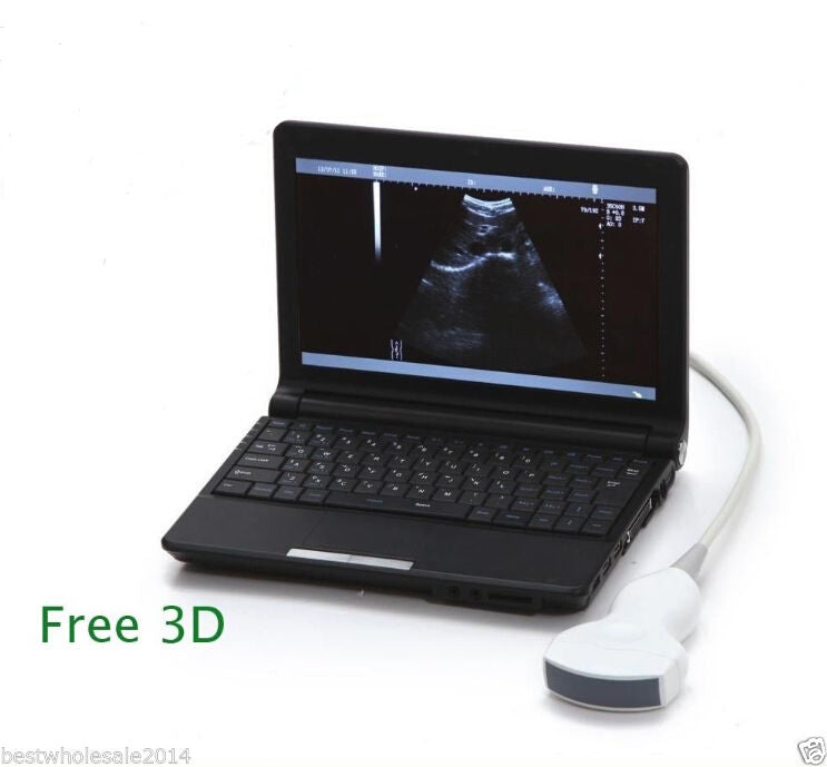 Laptop Ultrasound Scanner Diagnostic DiagnosisMachine Convex Probe Sale CE DIAGNOSTIC ULTRASOUND MACHINES FOR SALE