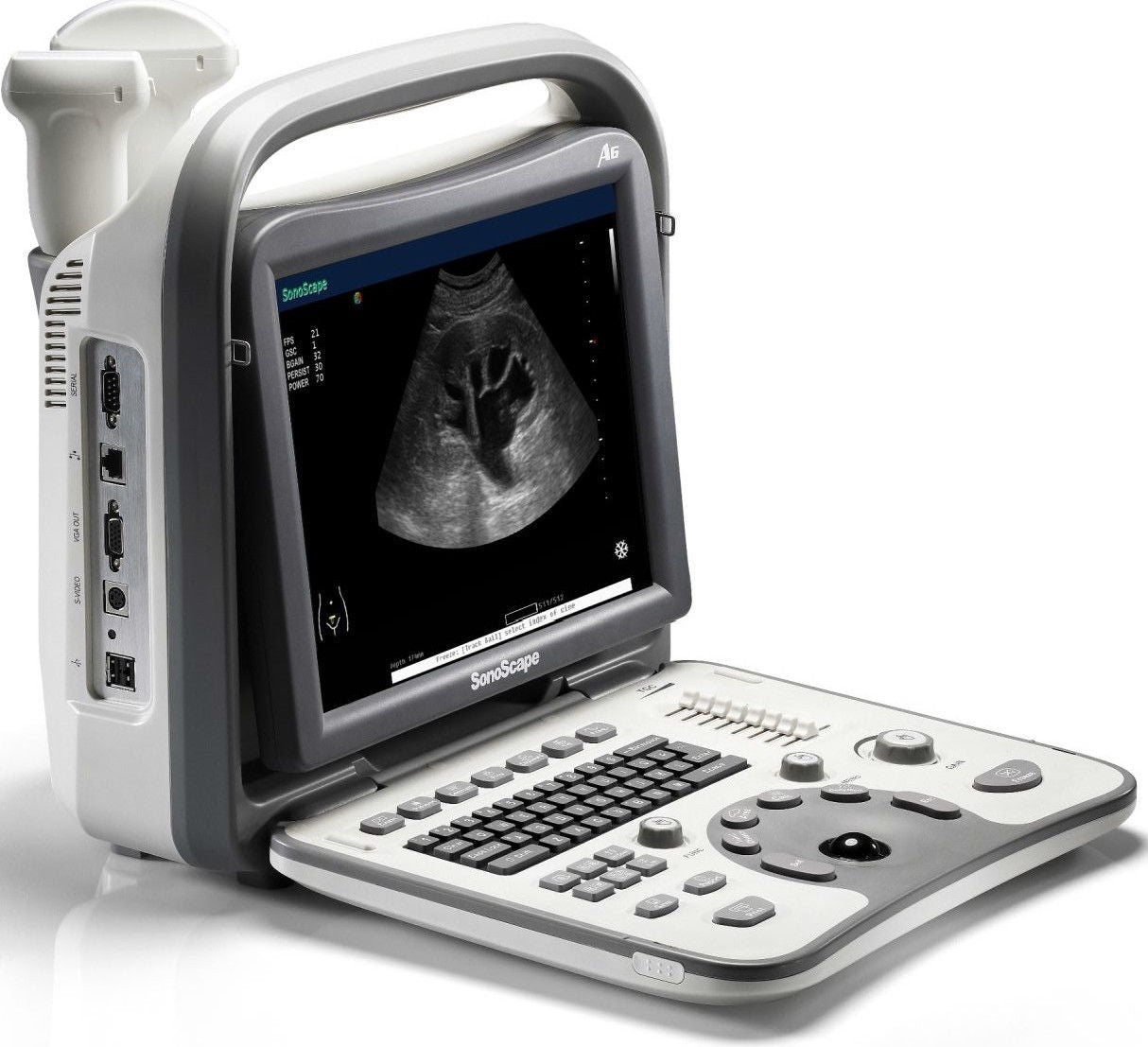 Veterinary Ultrasound Scanner Sonoscape A6V & Rectal Probe 5-11MHz and MC Probe DIAGNOSTIC ULTRASOUND MACHINES FOR SALE