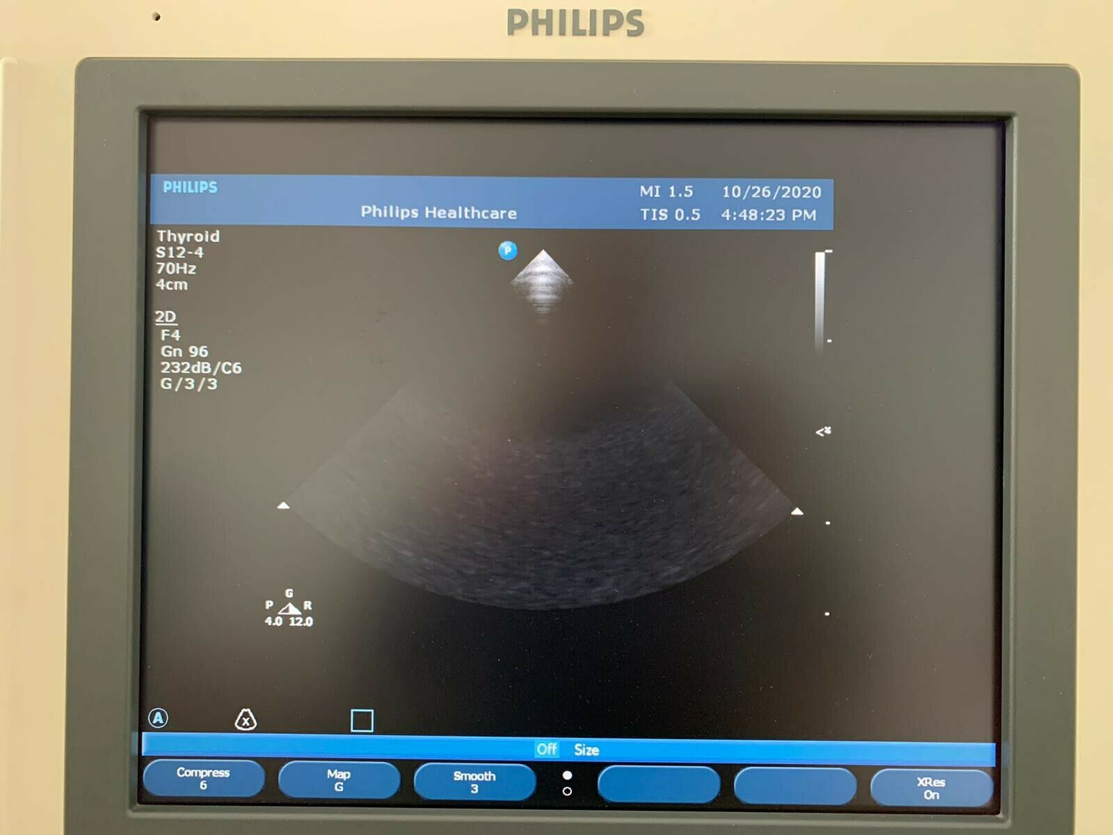 Philips  S12-4 Ultrasound Transducer Probe DIAGNOSTIC ULTRASOUND MACHINES FOR SALE