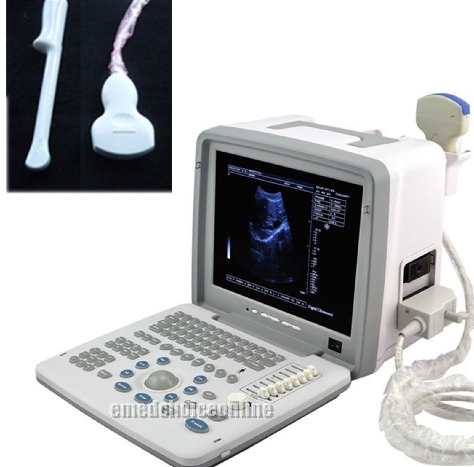 Large LED Digital 3D Ultrasound Scanner Machine +Convex &Transvaginal 2 Probes  190891662194 DIAGNOSTIC ULTRASOUND MACHINES FOR SALE