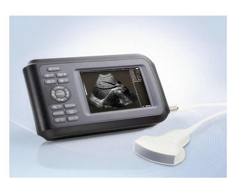 Portable Ultrasound Machine Scanner Ultrasound Device Convex Human Pregnancy A+ DIAGNOSTIC ULTRASOUND MACHINES FOR SALE