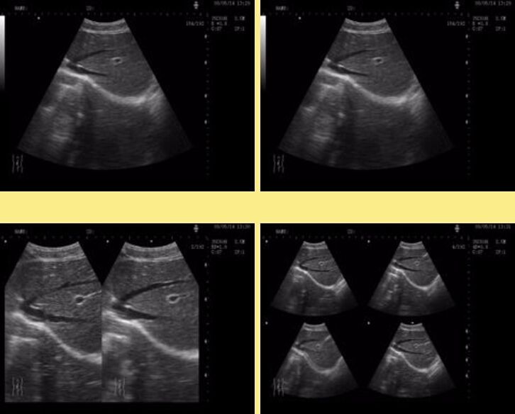 High Quality 3D Ultrasound Scanner Machine s+Convex + Vaginal+Linear 3 probes CE 190891351906 DIAGNOSTIC ULTRASOUND MACHINES FOR SALE