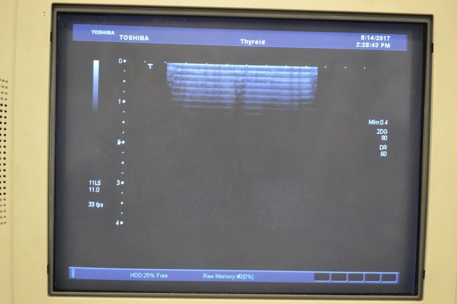 Toshiba Aplio PLT-704AT 6-11MHz Linear Ultrasound Transducer Probe DIAGNOSTIC ULTRASOUND MACHINES FOR SALE