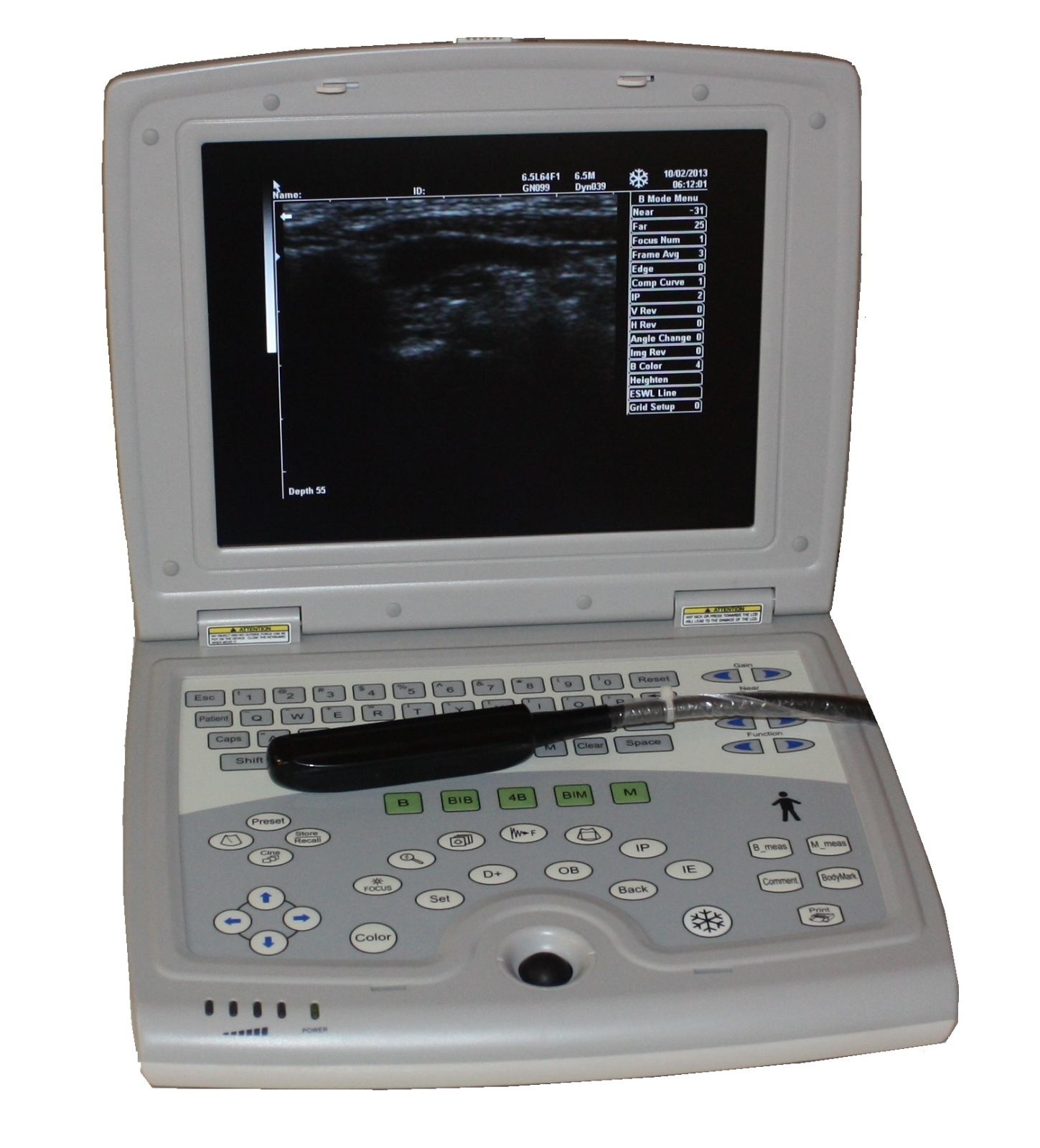 Veterinary Laptop Notebook Ultrasound Scanner with rectal probe-KX5000V-Keebomed DIAGNOSTIC ULTRASOUND MACHINES FOR SALE