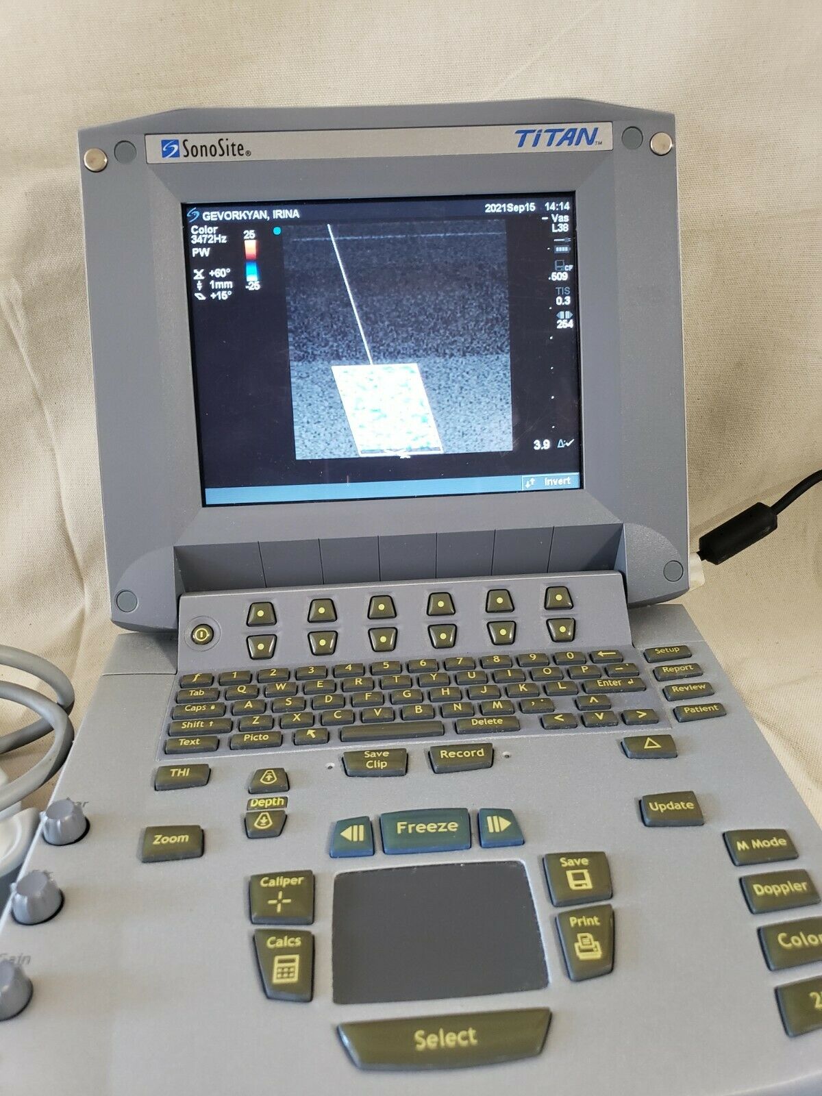 SONOSITE TITAN HIGH RESOLUTION ULTRASOUND SYSTEM WITH L38/10-5  C15/4-2 TRANSDUC DIAGNOSTIC ULTRASOUND MACHINES FOR SALE
