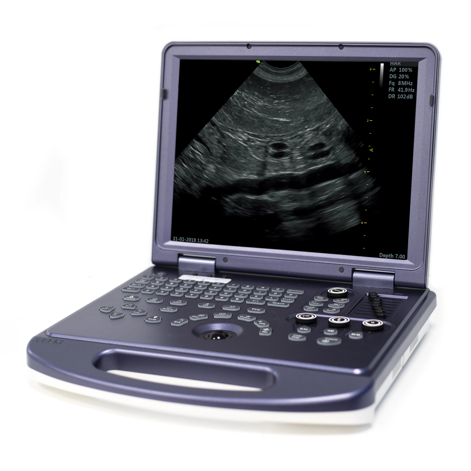 Veterinary Grade Ultrasound Scanner Laptop Vet Master Pro 4K Portable Cat/Dog/Pe DIAGNOSTIC ULTRASOUND MACHINES FOR SALE