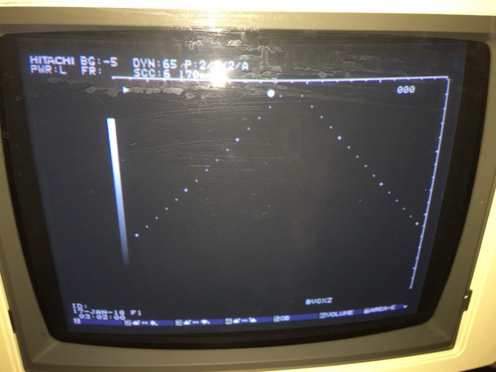 Hitachi EUB 525 Ultrasound Machine DIAGNOSTIC ULTRASOUND MACHINES FOR SALE