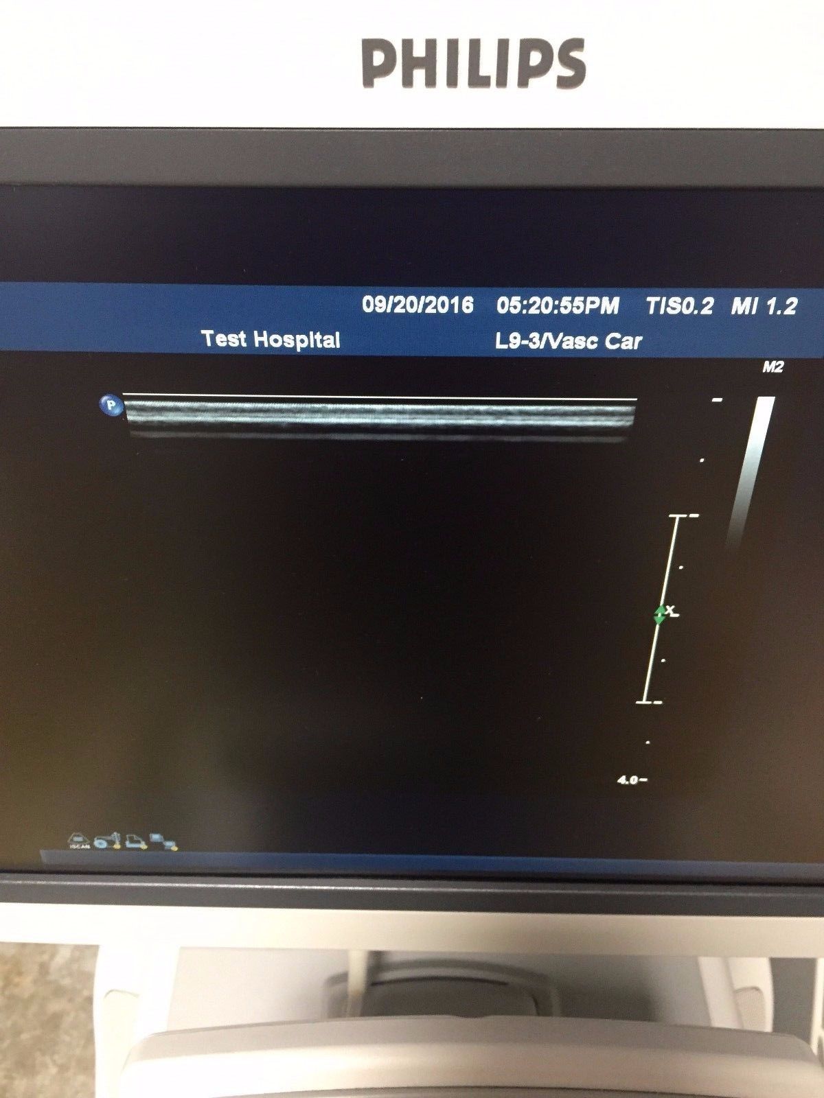 shot of monitor probe ultrasound