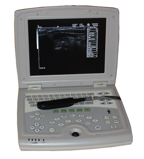 Veterinary Laptop - Animal Ultrasound Scanner - Bovine, Equine KeeboMed KX5000KV DIAGNOSTIC ULTRASOUND MACHINES FOR SALE