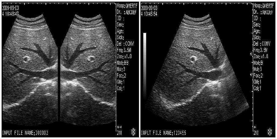 Veterianry Ultrasound Scanner Machine with VET Rectal Probe Caw horse 3D Free 190891435484 DIAGNOSTIC ULTRASOUND MACHINES FOR SALE