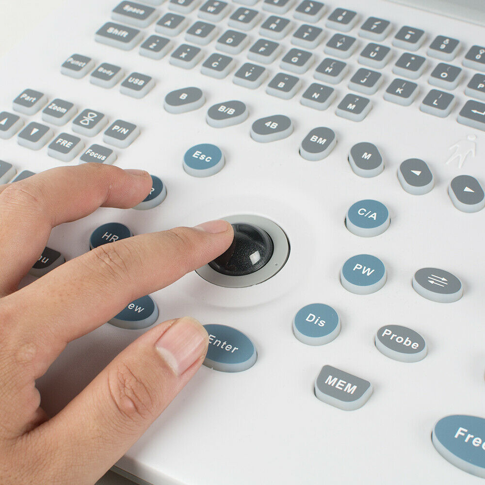 High Resolution Full Digital LCD Portable Ultrasound Scanner Machine Linear 3D DIAGNOSTIC ULTRASOUND MACHINES FOR SALE