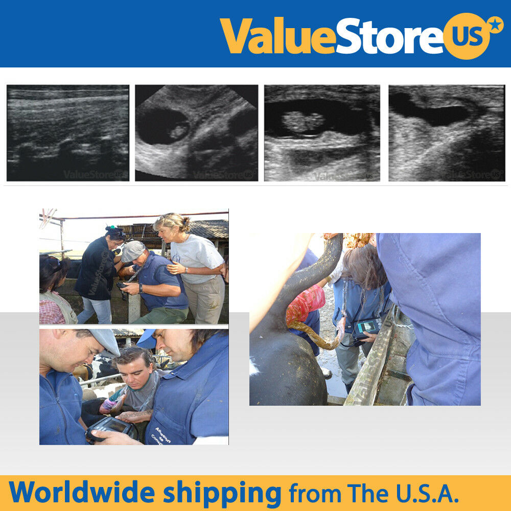 Portable Ultrasound Scanner V16 with 3.5 MHz Convex & 7.5 MHz Rectal Probe DIAGNOSTIC ULTRASOUND MACHINES FOR SALE