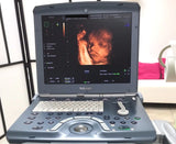 GE Voluson i Portable Ultrasound System