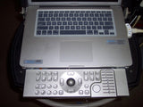 Terason t3000 Ultrasound System