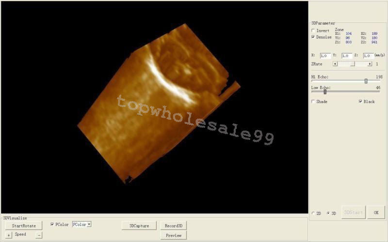 Veterinary Digital LCD Ultrasound Scanner+3D Software+convex+Micro-convex probe DIAGNOSTIC ULTRASOUND MACHINES FOR SALE