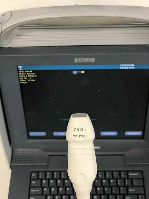 Siemens Acuson Cypress Portable Ultrasound Machine with 7V3c Probe Transducer DIAGNOSTIC ULTRASOUND MACHINES FOR SALE