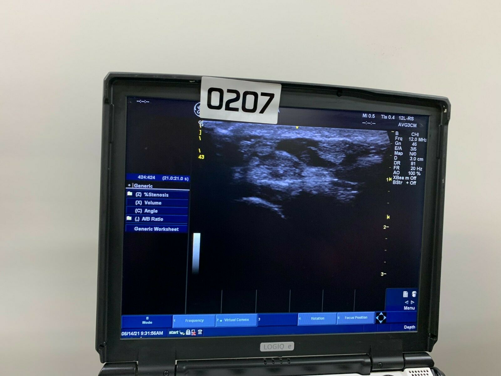 GE Logiq e NextGen Portable Ultrasound 5419804 W/12L-RS Probe V R7.0.3 0207 DIAGNOSTIC ULTRASOUND MACHINES FOR SALE