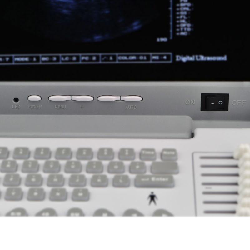 Full Digital Portable Ultrasound Scanner Convex &Transvaginal 2 Probe Free 3D A+ DIAGNOSTIC ULTRASOUND MACHINES FOR SALE