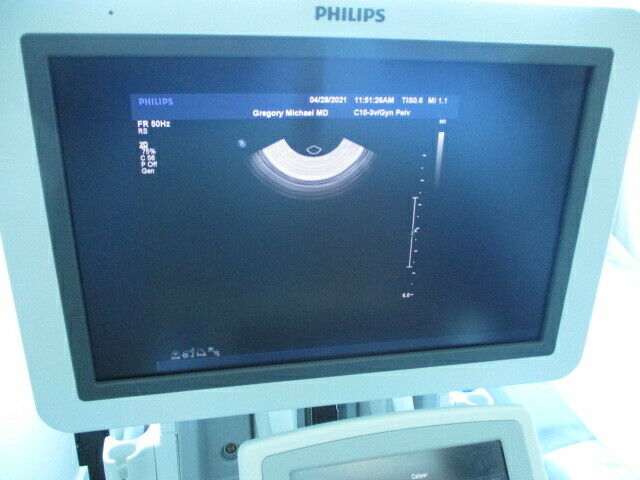 PHILIPS IU22 PORTABLE ULTRASOUND WITH 2 TRANSDUCERS! CONVEX AND ENDOVAGINAL! DIAGNOSTIC ULTRASOUND MACHINES FOR SALE