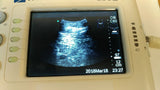 Sonosite 180 II PLUS portable ultrasound system MODULE + POWER SUPPLY P02456-02