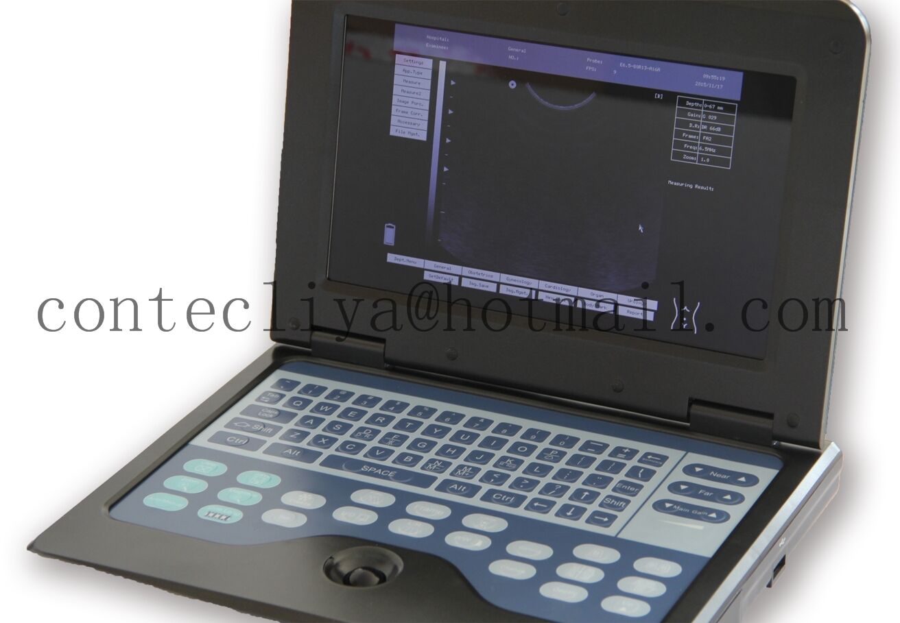 Portable Laptop Ultrasound Scanner Machine+2 Probes,Digital Diagnostic System,CE DIAGNOSTIC ULTRASOUND MACHINES FOR SALE