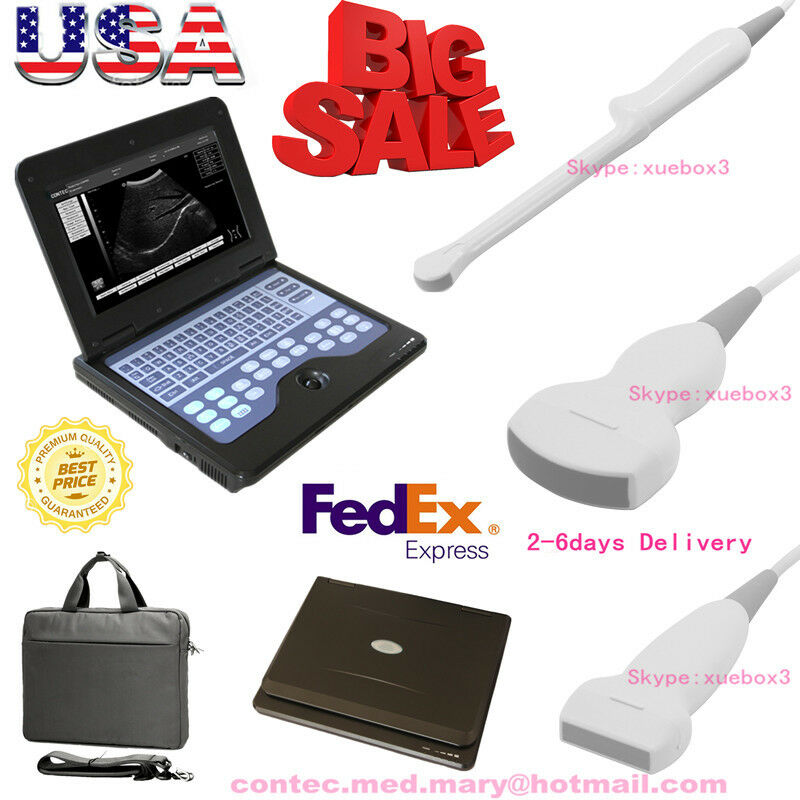 Portable ultrasound scanner laptop machine 3 Probes Convex/ Linear/ Transvaginal DIAGNOSTIC ULTRASOUND MACHINES FOR SALE