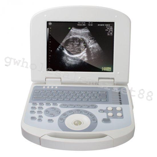 USA Top Resolution Laptop Medical Ultrasound Machine Scanner Convex probe Image 190891422491 DIAGNOSTIC ULTRASOUND MACHINES FOR SALE