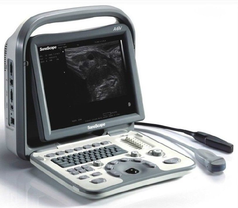 Veterinary Ultrasound Scanner Sonoscape A6V & Rectal Probe 5-11MHz and MC Probe DIAGNOSTIC ULTRASOUND MACHINES FOR SALE