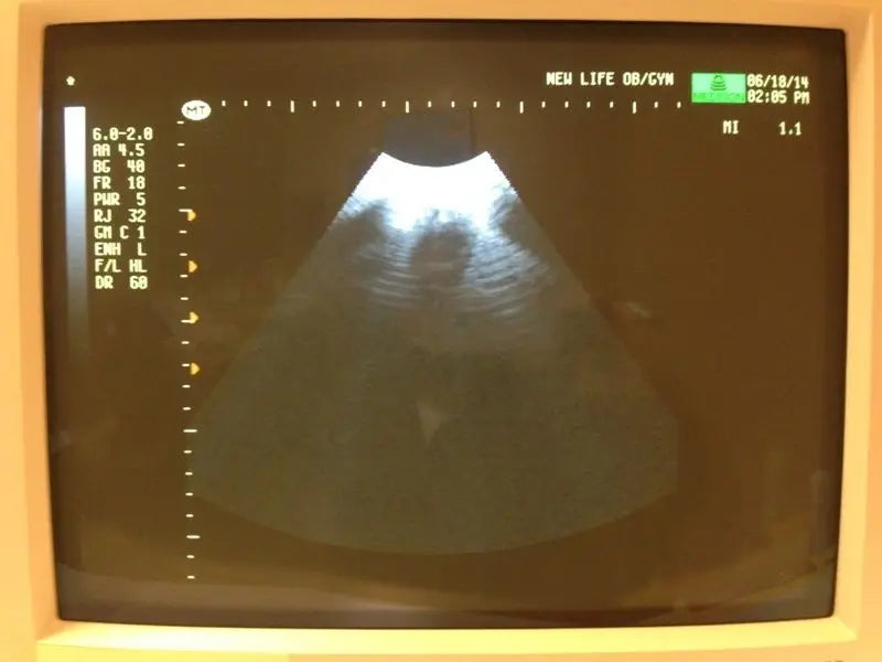 Medison Voluson 530D MT 3D/4D Ultrasound