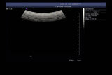 Siemens CH6-2 Ultrasound Probe