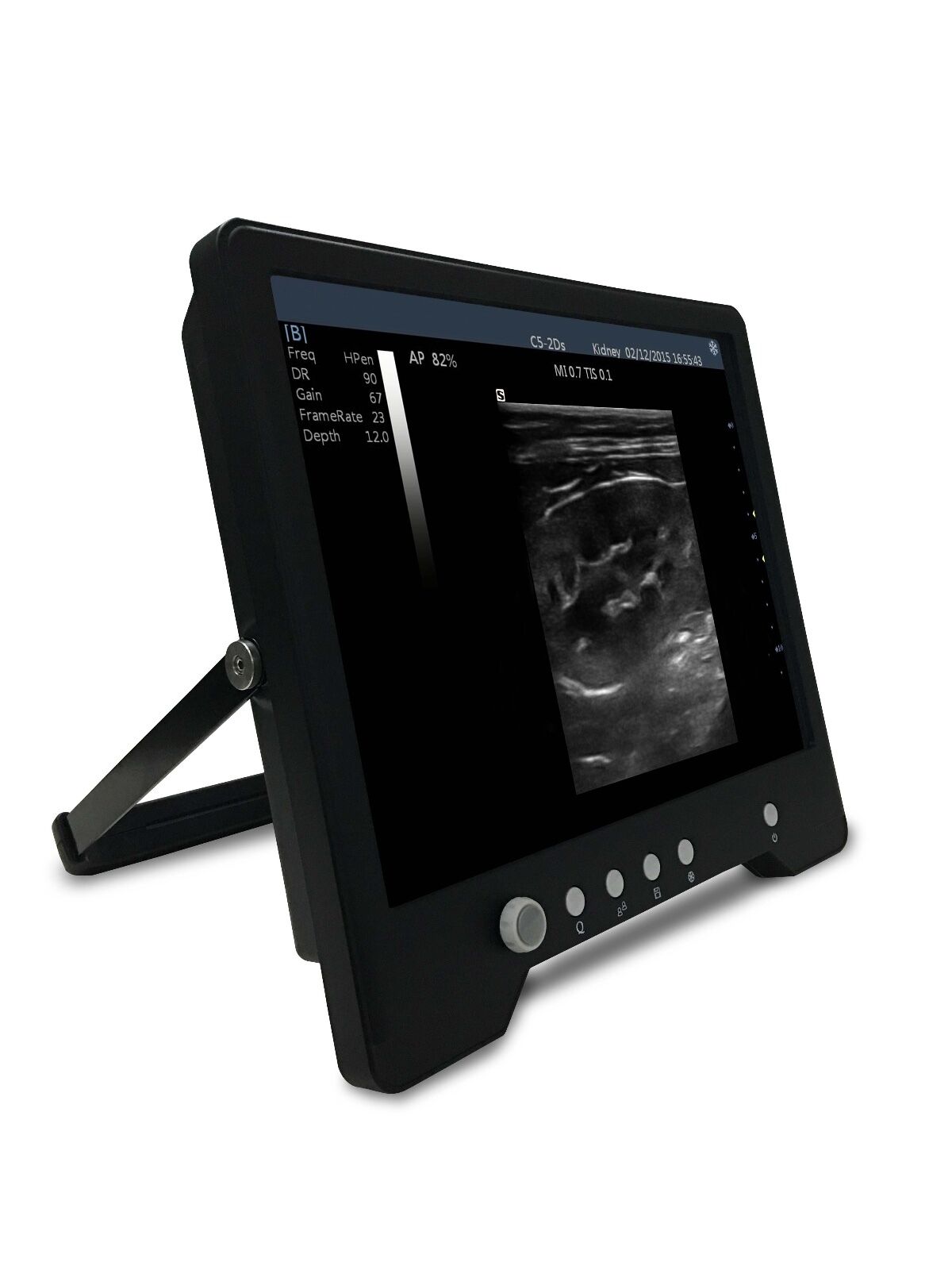 Veterinary Sheep, Goats, Pigs, Touch Screen Ultrasound & Convex Probe | KeeboMed DIAGNOSTIC ULTRASOUND MACHINES FOR SALE