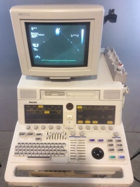 closeup of ultrasound screen