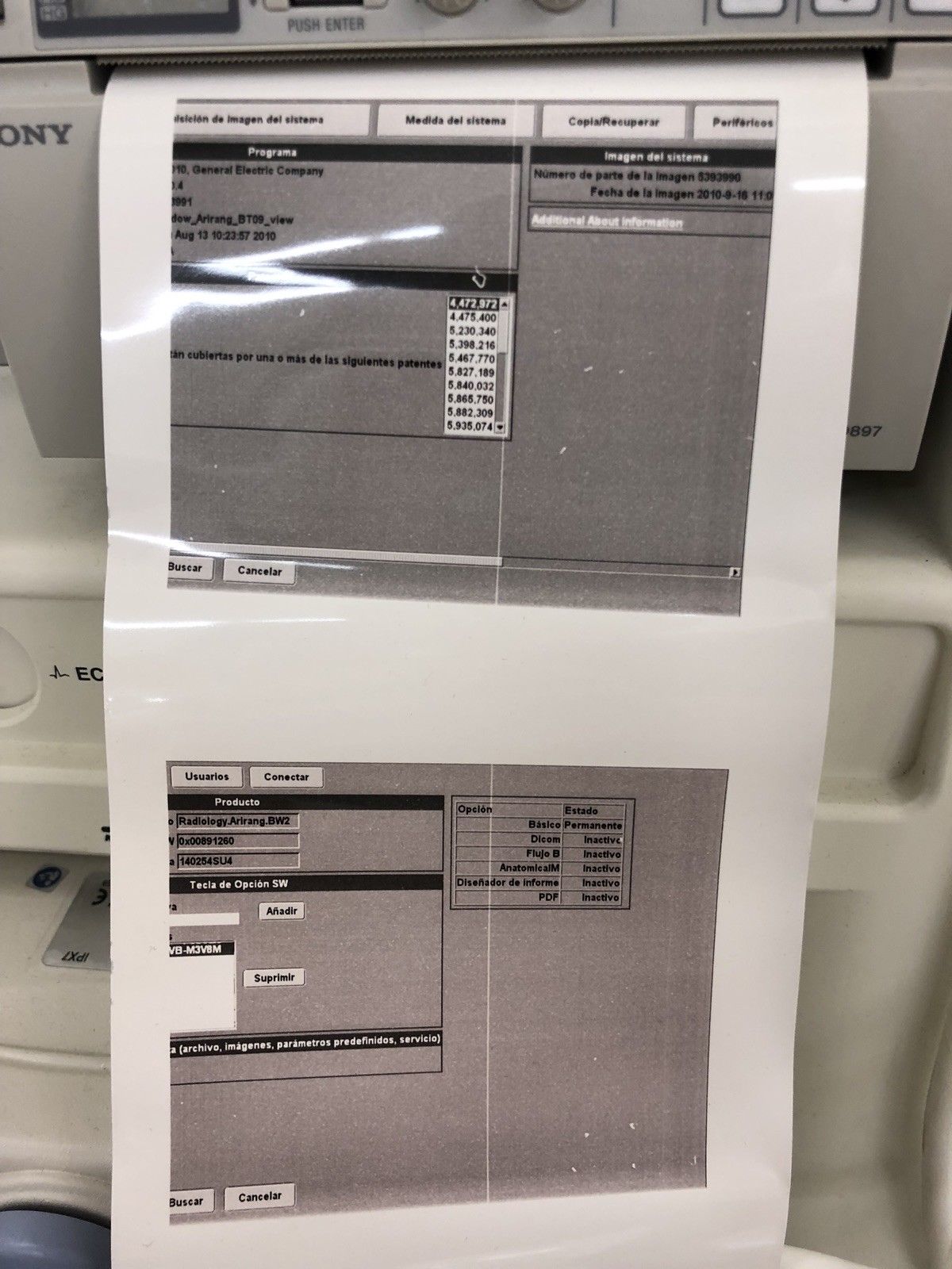 GE Logiq A5 Pro Ultrasound - Printer Included - Refurbished DIAGNOSTIC ULTRASOUND MACHINES FOR SALE