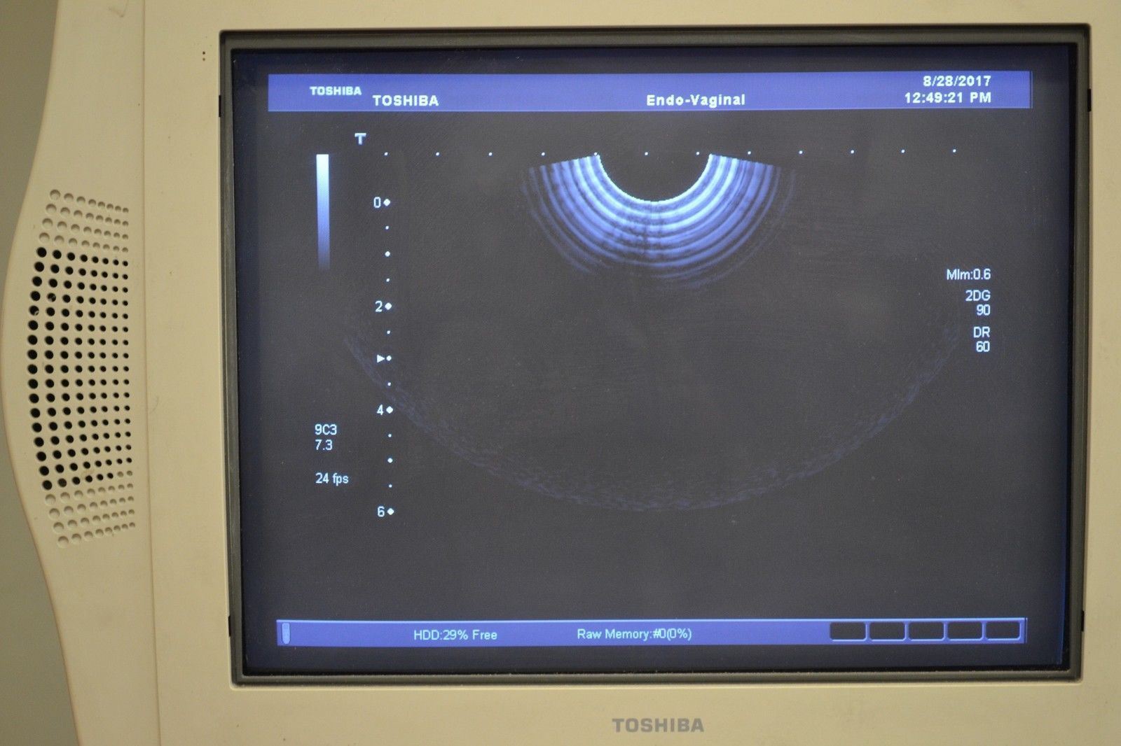 Toshiba Aplio 300 PVT-661VT 8.8-3.6 MHz Endorectal Ultrasound Transducer Probe DIAGNOSTIC ULTRASOUND MACHINES FOR SALE