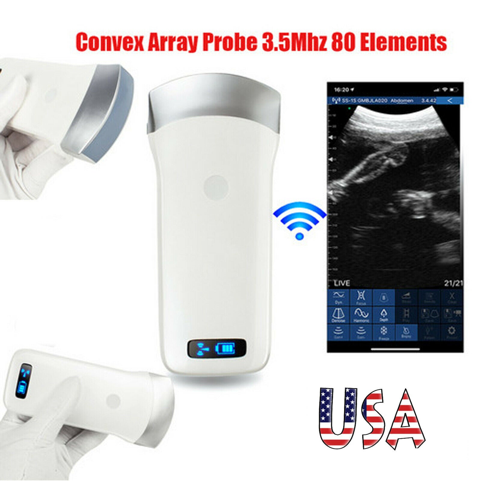 Portable Ultrasound Scanner Convex Array Probe 3.5Mhz 80 Elements +16 Channel CE DIAGNOSTIC ULTRASOUND MACHINES FOR SALE