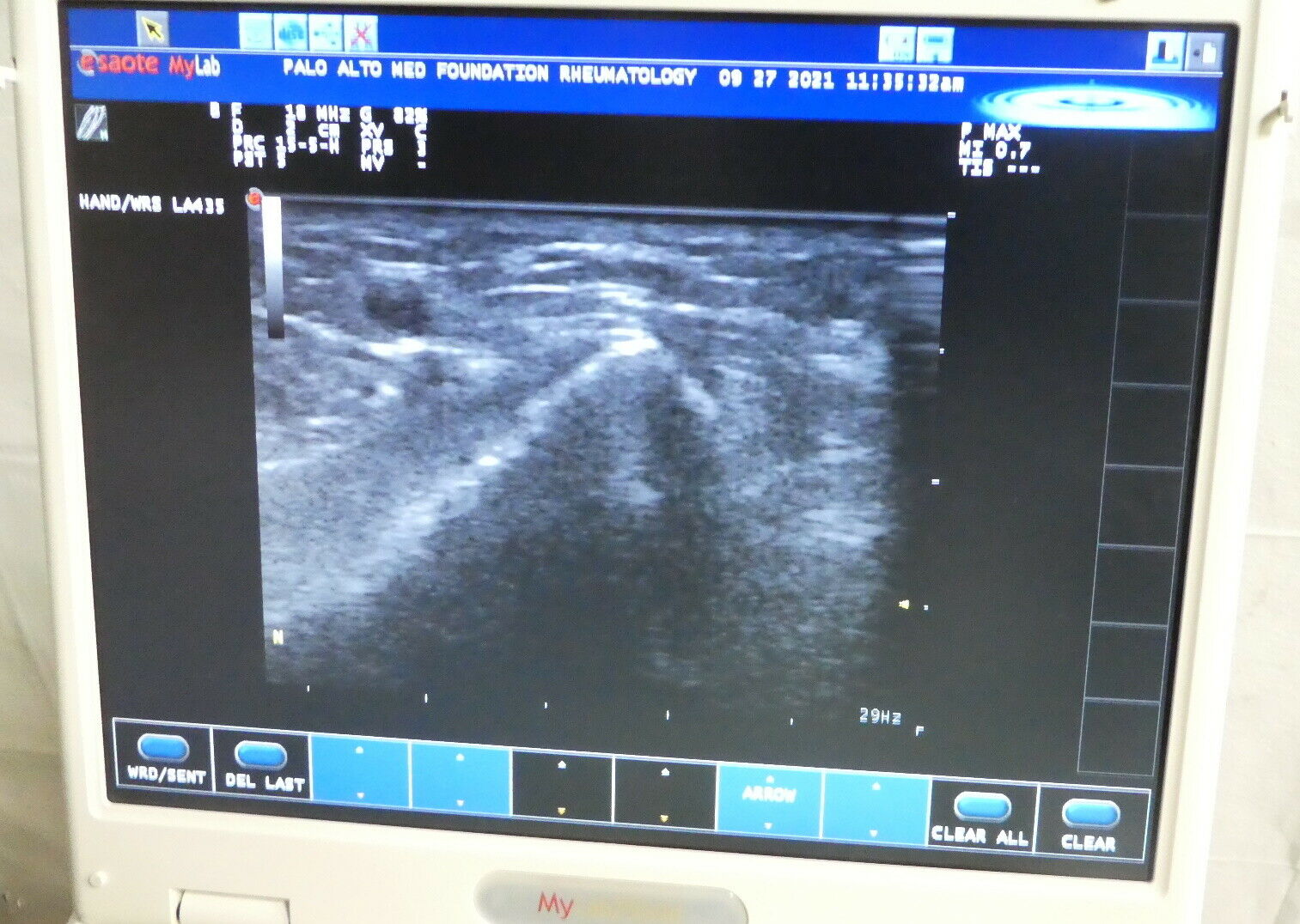 R178283 ESAOTE S.p.A. Biosound MyLab25Gold Ultrasound System - Two Probes DIAGNOSTIC ULTRASOUND MACHINES FOR SALE