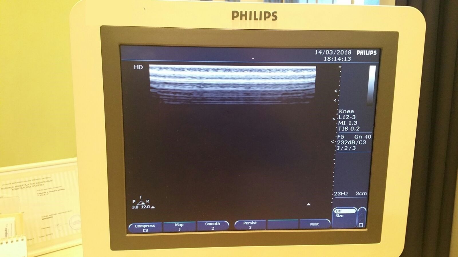 Philips HD7 Revision 1.1 Diagnostic Ultrasound System DIAGNOSTIC ULTRASOUND MACHINES FOR SALE