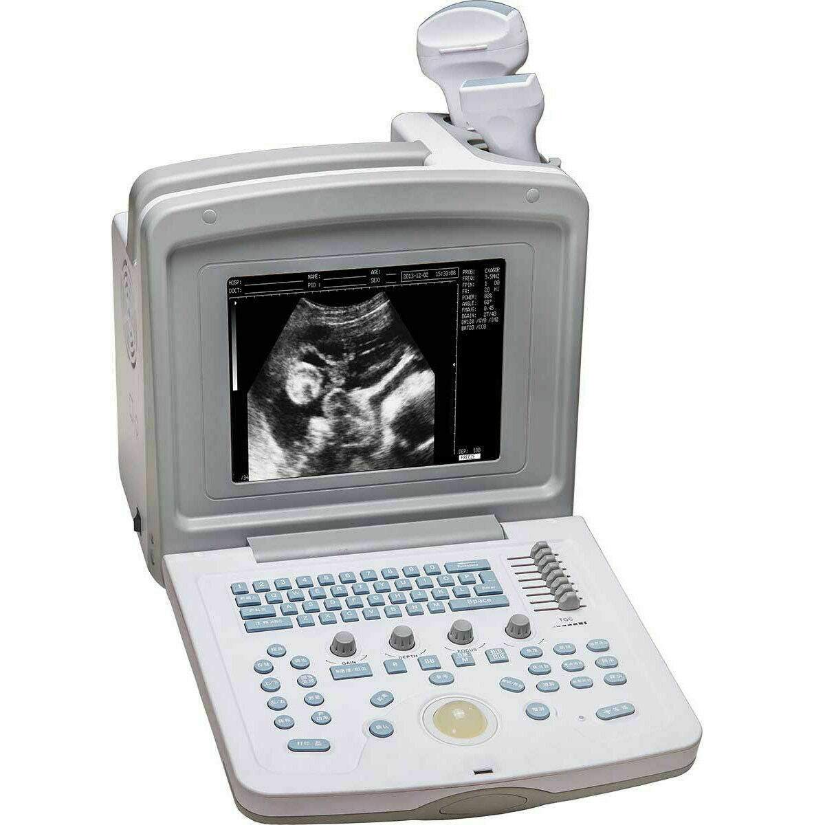 Welld 180 Veterinary Ultrasound Scanner with Choice of Probe - Many Sold in USA DIAGNOSTIC ULTRASOUND MACHINES FOR SALE