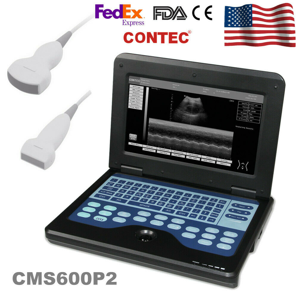 Portable Ultrasound Scanner Diagnostic Device Machine Convex / Linear 2 Probes DIAGNOSTIC ULTRASOUND MACHINES FOR SALE