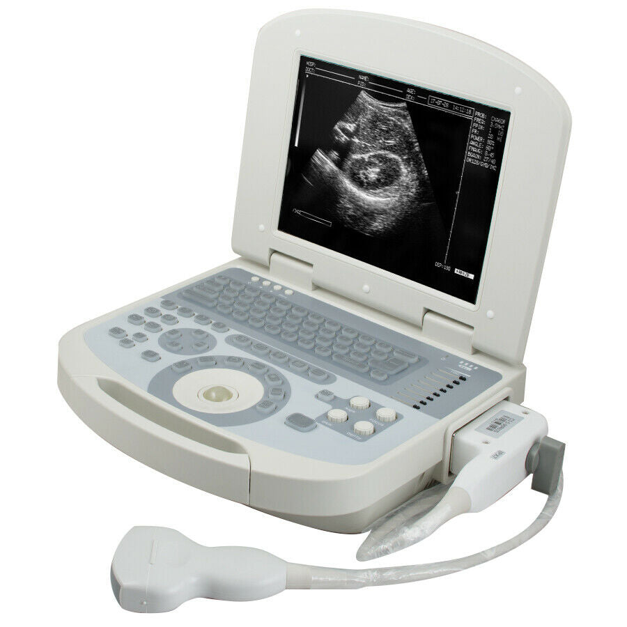 Digital Medical Ultrasound Scanner +3.5MHZ Convex Probe with 3D Software DIAGNOSTIC ULTRASOUND MACHINES FOR SALE