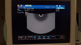 Biosound / Esaote MyLab 20 Diagnostic Ultrasound unit OB / GYN