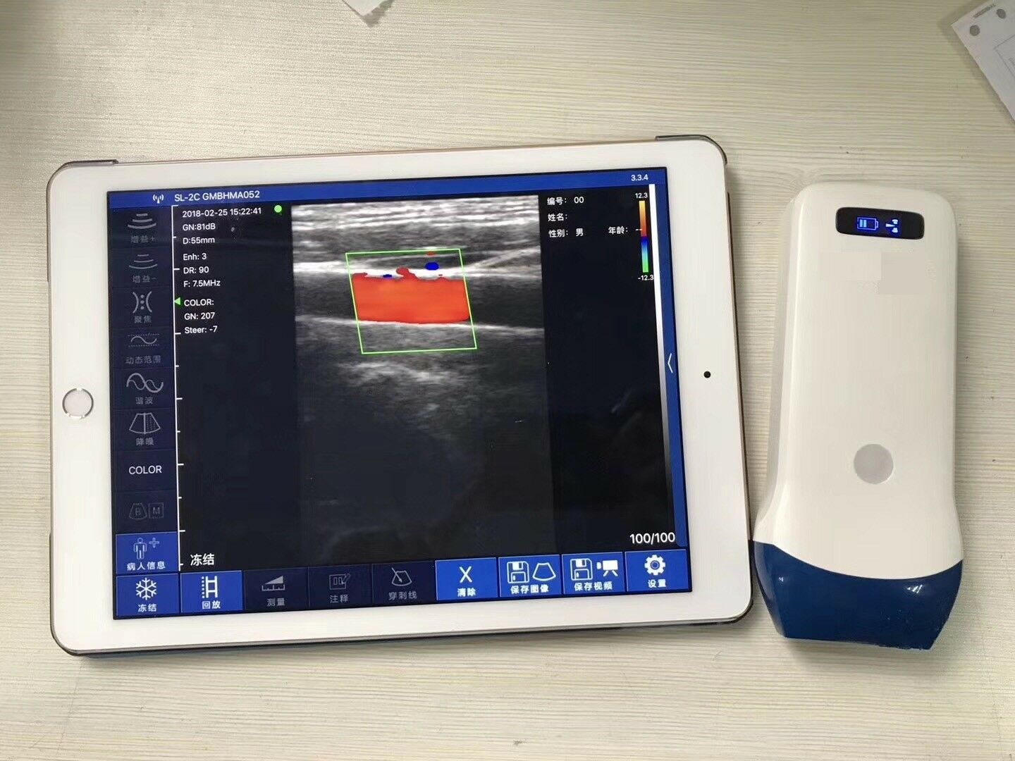 Wifi Ultrasound Color Doppler 7.5 MHz, discounted special DIAGNOSTIC ULTRASOUND MACHINES FOR SALE