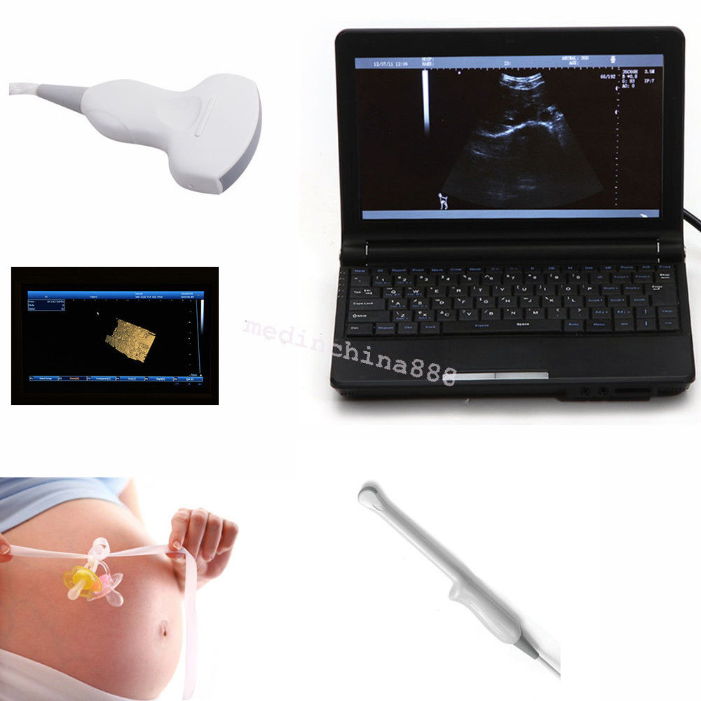 Laptop LCD Digital 10.1-Inch Ultrasound Scanner + Convex+Transvaginal Probe Care 190891247261 DIAGNOSTIC ULTRASOUND MACHINES FOR SALE