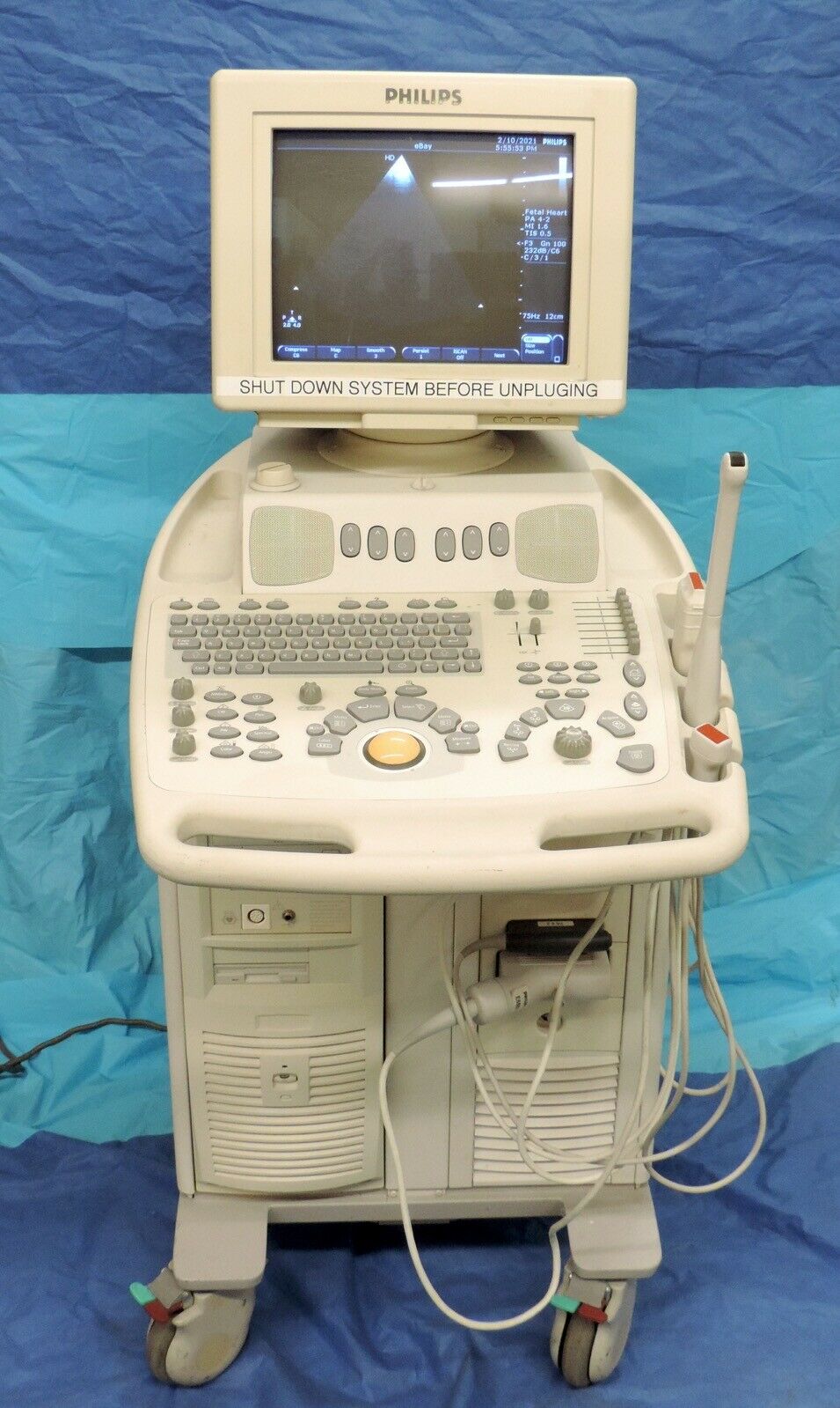 Philips EnVisor C M2540A HD CHD Ultrasound Machine System w/ Probes Transducers DIAGNOSTIC ULTRASOUND MACHINES FOR SALE