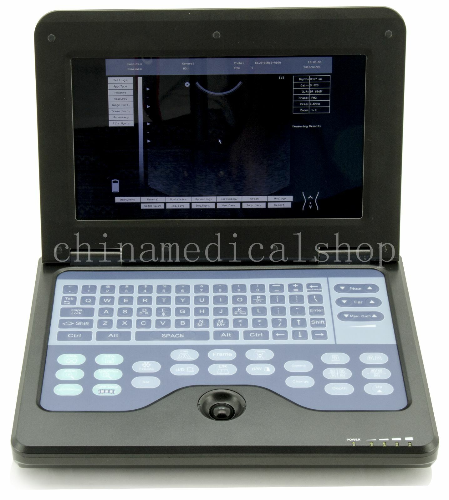 With Convex &Cardiac Sensors Digital Ultrasound Scanner Ultrasonic Machine USA DIAGNOSTIC ULTRASOUND MACHINES FOR SALE