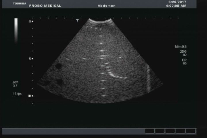 Toshiba PVT-382BT Ultrasound Probe DIAGNOSTIC ULTRASOUND MACHINES FOR SALE