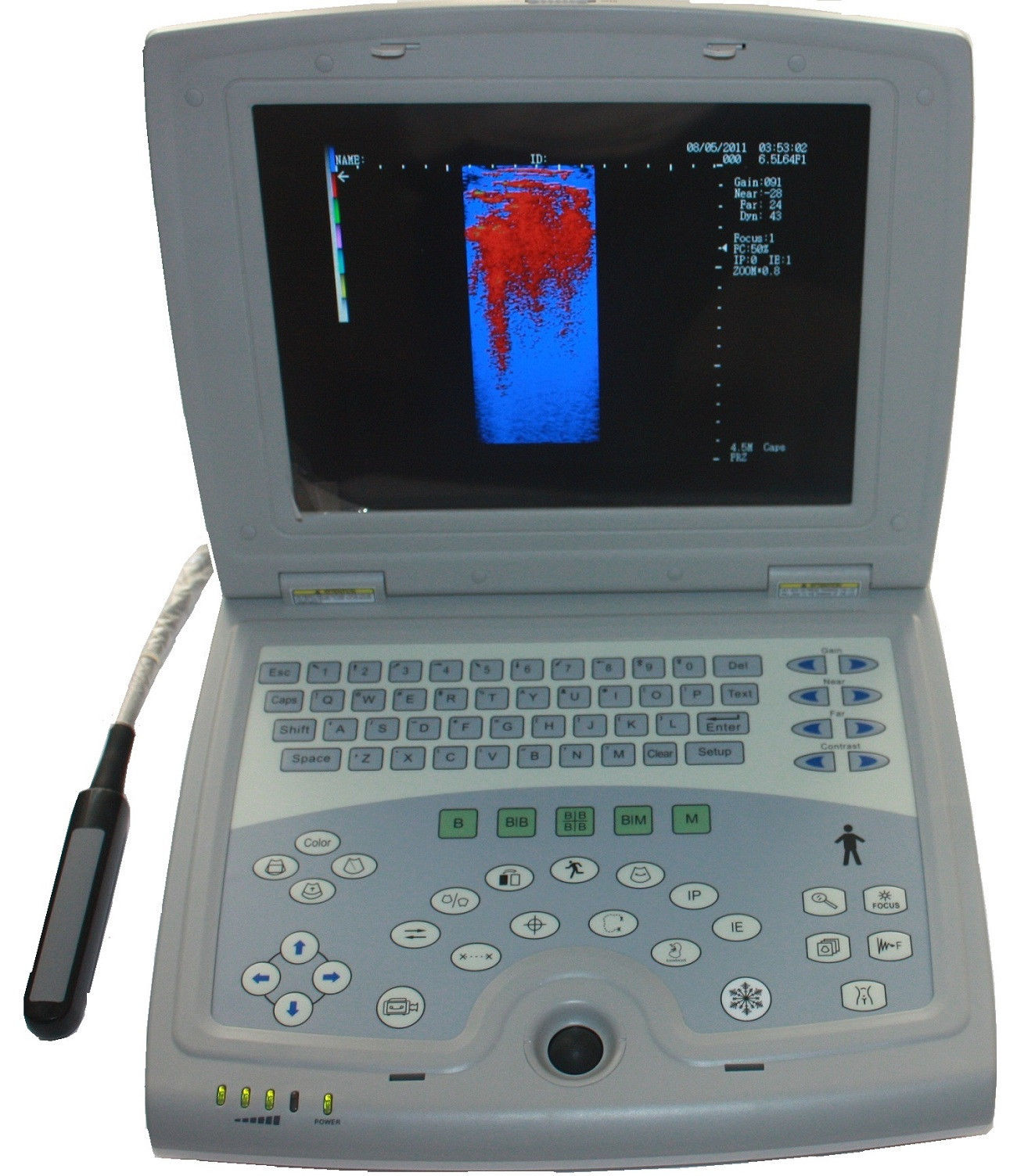 Veterinary Laptop Notebook Ultrasound Scanner with rectal probe-KX5000V-Keebomed DIAGNOSTIC ULTRASOUND MACHINES FOR SALE