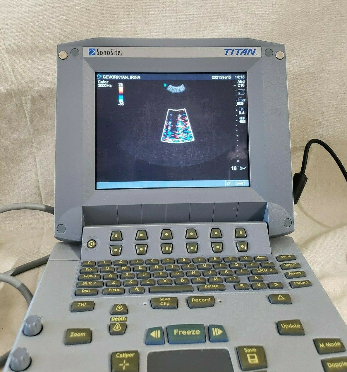 SONOSITE TITAN HIGH RESOLUTION ULTRASOUND SYSTEM WITH L38/10-5  C15/4-2 TRANSDUC DIAGNOSTIC ULTRASOUND MACHINES FOR SALE