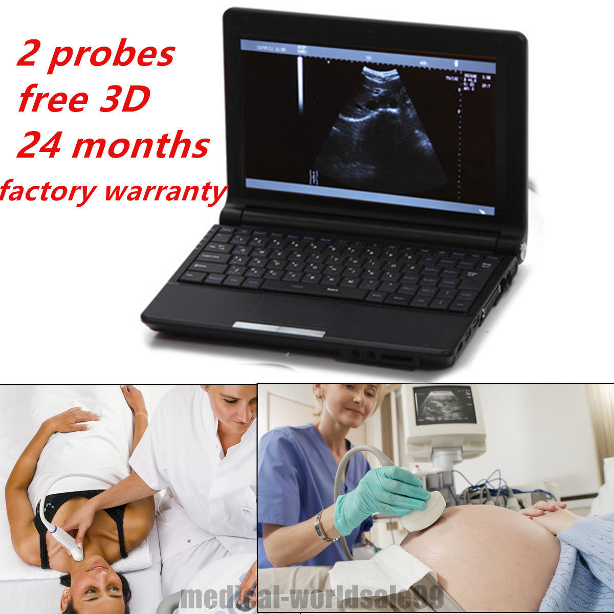 Notebook Digital Ultrasound Scanner/Exam Machine  Convex + Linear 2 Probes 3D AA DIAGNOSTIC ULTRASOUND MACHINES FOR SALE